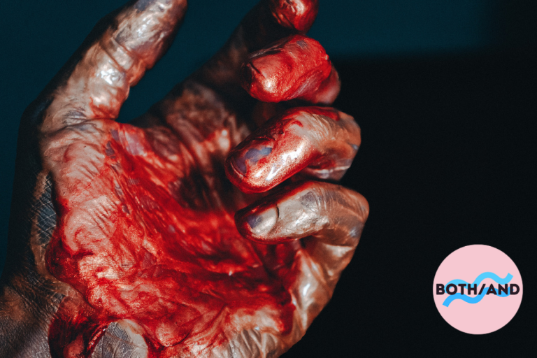 An open hand covered in blood.